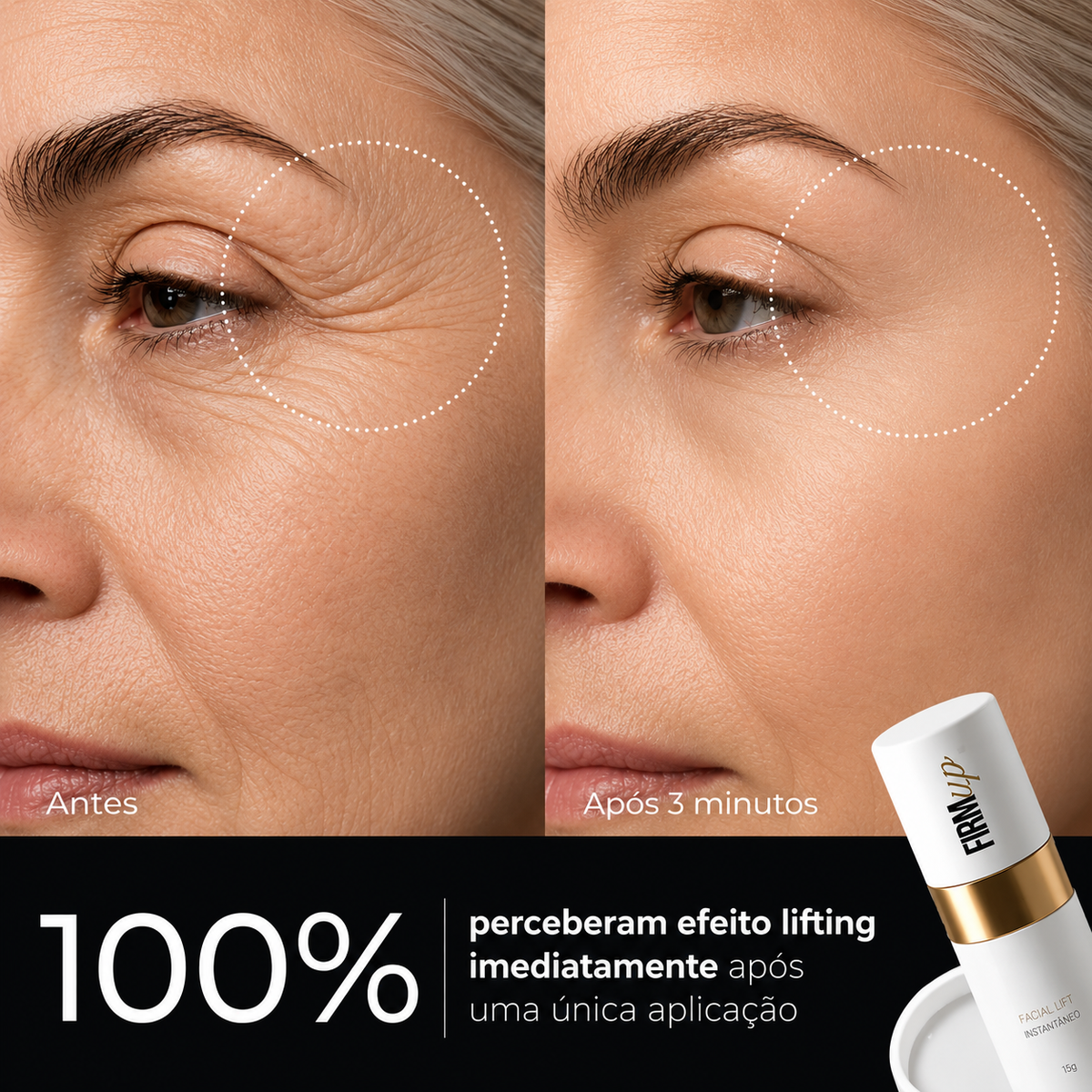 Kit Tratamento Completo 5 Sérum Antirrugas Lift Instantâneo FIRMup